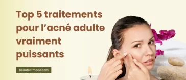 Top 5 traitements pour l’acné adulte vraiment puissants