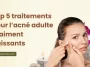 Top 5 traitements pour l’acné adulte vraiment puissants